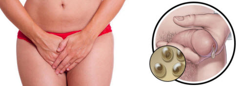 Doxycycline for chlamydia